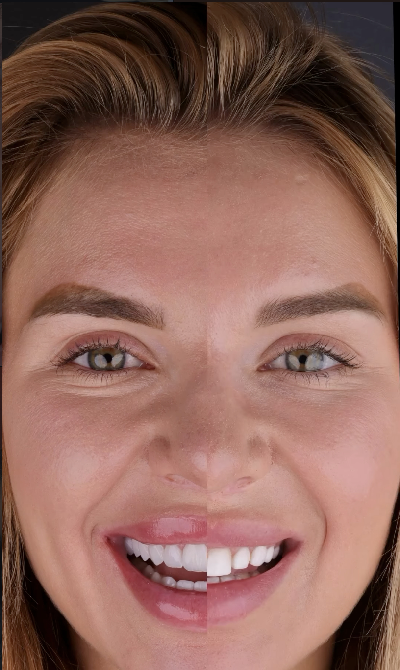 Dental treatment before and after — Limassol